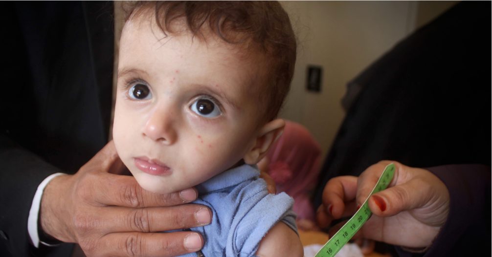 young toddler from yemen