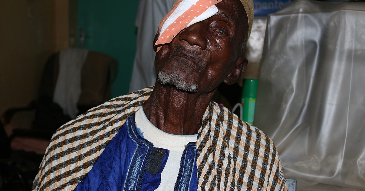 Man with patch over one eye.