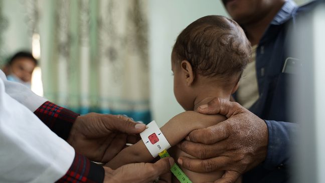 a baby's arm being measured by a measuring tape, yemen malnutrition clinic by islamic relief